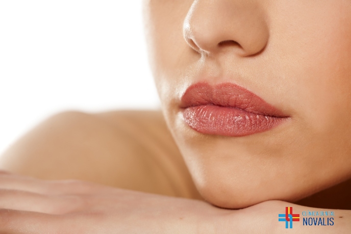 Relleno de labios con ácido&nbsp;hialurónico.